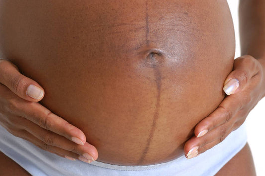 pregnant belly showing pregnancy line
